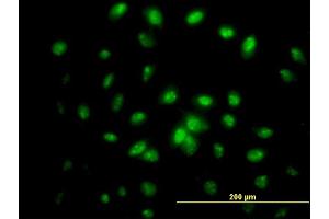 Immunofluorescence of monoclonal antibody to IFRD2 on HeLa cell. (IFRD2 antibody  (AA 1-442))