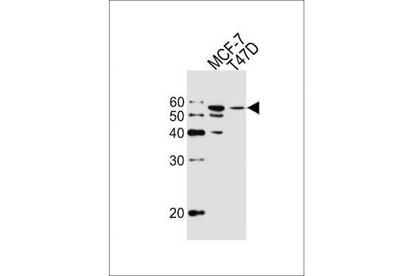 ALDH6A1 antibody