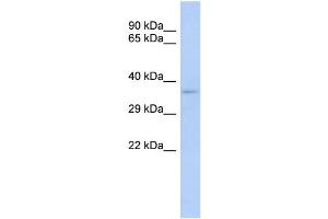 WB Suggested Anti-TRADD Antibody Titration:  0. (TRADD antibody  (Middle Region))