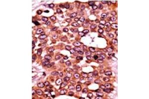 Image no. 2 for anti-Cell Division Cycle 6 Homolog (S. Cerevisiae) (CDC6) (pSer54) antibody (ABIN358103) (CDC6 antibody  (pSer54))