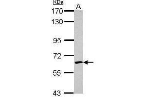 WB Image Sample (30 ug of whole cell lysate) A: HeLa 7. (Crossover junction endonuclease EME1 (EME1) (Internal Region) antibody)