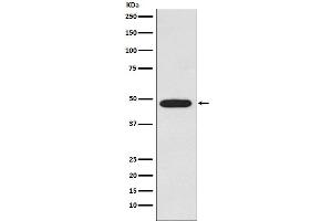 Western blot analysis of Galactosidase alpha expression in MCF-7 cell lysate.