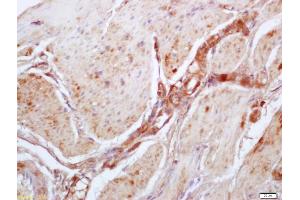 Formalin-fixed and paraffin embedded mouse stomach labeled with Anti-Phospho-MYPT1(Thr696) Polyclonal Antibody, Unconjugated (ABIN744068) at 1:200 followed by conjugation to the secondary antibody and DAB staining (PPP1R12A antibody  (pThr696))