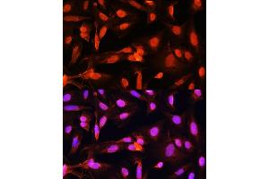 Immunofluorescence analysis of U20S cells using SGOL1 antibody (ABIN7270288) at dilution of 1:100. (Shugoshin antibody  (AA 10-100))