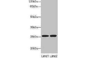 Western blot All lanes: EEF1AKMT1 antibody at 10 μg/mL Lane 1: Jurkat whole cell lysate Lane 2: 293T whole cell lysate Secondary Goat polyclonal to rabbit IgG at 1/10000 dilution Predicted band size: 25 kDa Observed band size: 25 kDa (EEF1A Lysine Methyltransferase 1 (EEF1AKMT1) (AA 2-214) antibody)