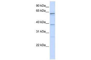Western Blotting (WB) image for anti-RNA Binding Motif Protein 39 (RBM39) antibody (ABIN2458513) (RBM39 antibody)