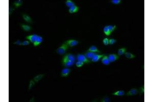 Immunofluorescence staining of Hela cells with ABIN7152472 at 1:100, counter-stained with DAPI. (FBXL2 antibody  (AA 1-423))