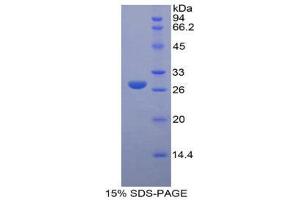 SDS-PAGE (SDS) image for Lysyl Oxidase-Like 3 (LOXL3) (AA 509-712) protein (His tag) (ABIN2125760)