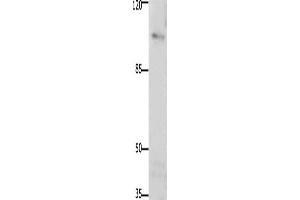 Western Blotting (WB) image for anti-PTK2 Protein tyrosine Kinase 2 (PTK2) antibody (ABIN2425841) (FAK antibody)