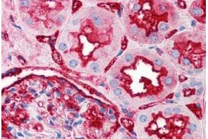 Human Kidney (formalin-fixed, paraffin-embedded) stained with TNFRSF12A antibody ABIN214532 at 2. (TNFRSF12A antibody)