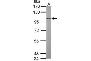 Western Blotting (WB) image for anti-Tubulin, gamma Complex Associated Protein 2 (TUBGCP2) (N-Term) antibody (ABIN2855343)