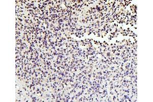 IHC analysis of SOX15 using anti-SOX15 antibody (ABIN6719624). (SOX15 antibody  (AA 1-233))