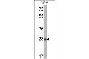 Western blot analysis of IGFBP6 Antibody in CEM cell line lysates (35ug/lane) (IGFBP6 antibody  (C-Term))