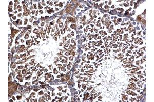 IHC-P Image Edc3 antibody [N2C2], Internal detects Edc3 protein at cytosol on mouse testis by immunohistochemical analysis. (EDC3 antibody  (Internal Region))