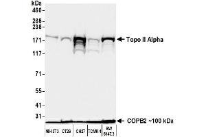 Western Blotting (WB) image for anti-Topo IIalpha (AA 650-700) antibody (ABIN7795794) (Recombinant Topo IIalpha (AA 650-700) antibody)