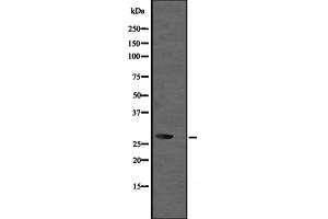 Western blot analysis of UBE2R2 expression in Jurkat whole cell lysate ,The lane on the left is treated with the antigen-specific peptide.