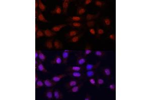 Immunofluorescence analysis of HeLa cells using N5-Methylcytidine antibody (ABIN1678489, ABIN3016020, ABIN3016022 and ABIN6219497) at dilution of 1:100. (5-Methylcytosine antibody)