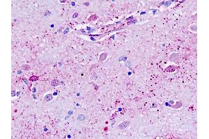 Human, Brain, neurons: Formalin-Fixed Paraffin-Embedded (FFPE) (GPR162 antibody  (Transmembrane Domain))