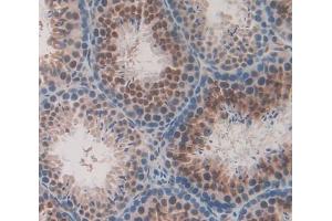 Used in DAB staining on fromalin fixed paraffin- embedded Kidney tissue (UXT antibody  (AA 11-157))