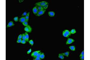 Immunofluorescent analysis of HepG2 cells using ABIN7171269 at dilution of 1:100 and Alexa Fluor 488-congugated AffiniPure Goat Anti-Rabbit IgG(H+L) (STXBP6 antibody  (AA 2-210))