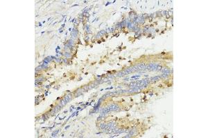Immunohistochemistry of paraffin-embedded rat lung using IGF1 antibody (ABIN6134370, ABIN6142231, ABIN6142233 and ABIN6215544) at dilution of 1:100 (40x lens). (IGF1 antibody  (AA 50-150))