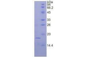 Image no. 1 for Fibroblast Growth Factor 1 (Acidic) (FGF1) (AA 16-155) (Active) protein (His tag) (ABIN6239853) (FGF1 Protein (AA 16-155) (His tag))