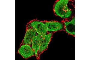 Immunofluorescence analysis of SMMC-7721 cells using GRM7 mouse mAb (green). (GRM7 antibody  (AA 454-590))