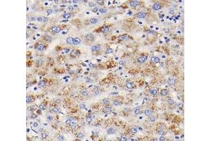 Immunohistochemistry analysis of paraffin-embedded human liver using,TFR2 (ABIN7075965) at dilution of 1: 400 (Transferrin Receptor 2 antibody)