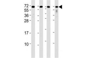 Western Blotting (WB) image for anti-CD63 (CD63) (AA 163-190) antibody (ABIN3030409)