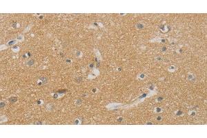 Immunohistochemistry of paraffin-embedded Human brain using NDRG1 Polyclonal Antibody at dilution of 1:70 (NDRG1 antibody)