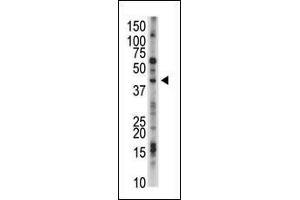 The anti-USP12 Pab (ABIN388898 and ABIN2839184) is used in Western blot to detect USP12 in mouse kidney tissue lysate. (USP12 antibody  (N-Term))