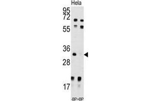 Western blot analysis of anti-UCK2 Antibody (N-term) pre-incubated with and without blocking peptide in Hela cell line lysate. (UCK2 antibody  (N-Term))