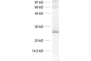 dilution: 1 : 1000, sample: rat brain homogenate (Caveolin-1 antibody  (AA 1-17))