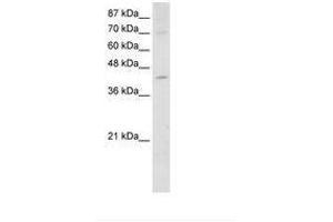 Image no. 2 for anti-Nuclear RNA Export Factor 5 (NXF5) (AA 153-202) antibody (ABIN203107) (NXF5 antibody  (AA 153-202))