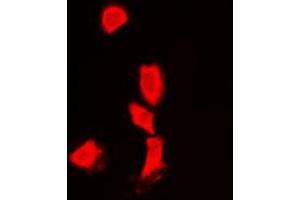 Immunofluorescent analysis of Histone Deacetylase 6 staining in Jurkat cells. (HDAC6 antibody  (N-Term))