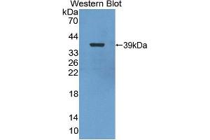 Western blot analysis of the recombinant protein. (Nuclear Factor kappa B2 (AA 37-342) antibody)