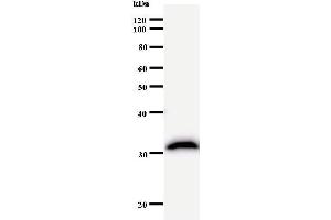 Western Blotting (WB) image for anti-CREB Binding Protein (CREBBP) antibody (ABIN932995) (CBP antibody)