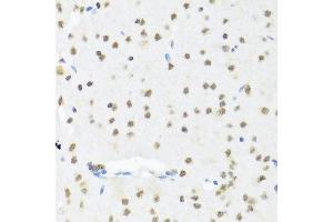 Immunohistochemistry of paraffin-embedded mouse brain using SET antibody at dilution of 1:100 (x40 lens). (SET/TAF-I antibody)