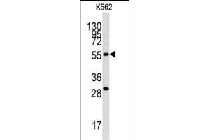 Western blot analysis of anti-CLIC5 Antibody (ABIN391843 and ABIN2841681) in K562 cell line lysates (35 μg/lane). (CLIC5 antibody)