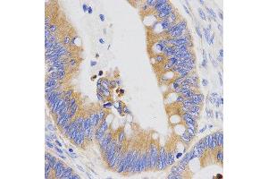 Immunohistochemistry (IHC) image for anti-Pepsinogen C (PGC) (AA 100-200) antibody (ABIN3016695) (PGC antibody  (AA 100-200))