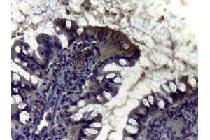 Immunohistochemistry of Rabbit anti Carbonic Anhydrase II antibody Tissue: intestine Staining: diffuse positivity of enzyma Carbonic Anidrase II in brush border of villus (CA2 antibody)