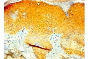 Immunohistochemistry of paraffin-embedded human skin tissue using ABIN7171970 at dilution of 1:100