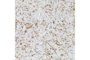 Immunohistochemistry of paraffin-embedded human brain using CLN8 antibody (ABIN7266285) at dilution of 1:300 (40x lens). (CLN8 antibody)