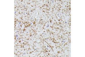 Immunohistochemistry of paraffin-embedded human brain using CLN8 antibody (ABIN7266285) at dilution of 1:300 (40x lens).
