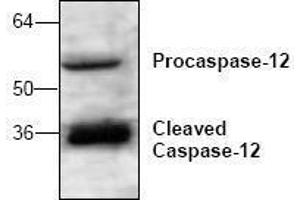 Image no. 1 for anti-Caspase 12 (Gene/pseudogene) (CASP12) antibody (ABIN127076) (Caspase 12 antibody)