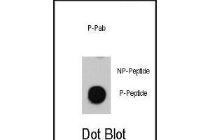Dot blot analysis of anti-Phospho-ATM-p Antibody (ABIN389888 and ABIN2839734) on nitrocellulose membrane. (ATM antibody  (pSer1981))