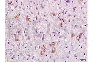 Formalin-fixed and paraffin embedded rat brain tissue labeled with Anti-APC/Adenomatous Polyposis Coli Polyclonal Antibody, Unconjugated (ABIN702550) at 1:200 followed by conjugation to the secondary antibody, (SP-0023), and DAB staining (APC antibody  (AA 2751-2843))