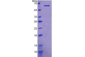 SDS-PAGE (SDS) image for Kininogen (High Molecular Weight) (AA 268-540) protein (His tag,SUMO Tag) (ABIN1878781)