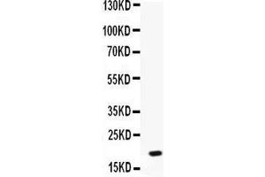 Western blot analysis of NAP2 expression in MCF-7 whole cell lysates (lane 1). (CXCL7 antibody  (AA 55-128))