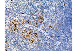 ABIN6255252 and ABIN6267093 at 1/100 staining Mouse spleen tissue by IHC-P. (ATG13 antibody  (pSer355))